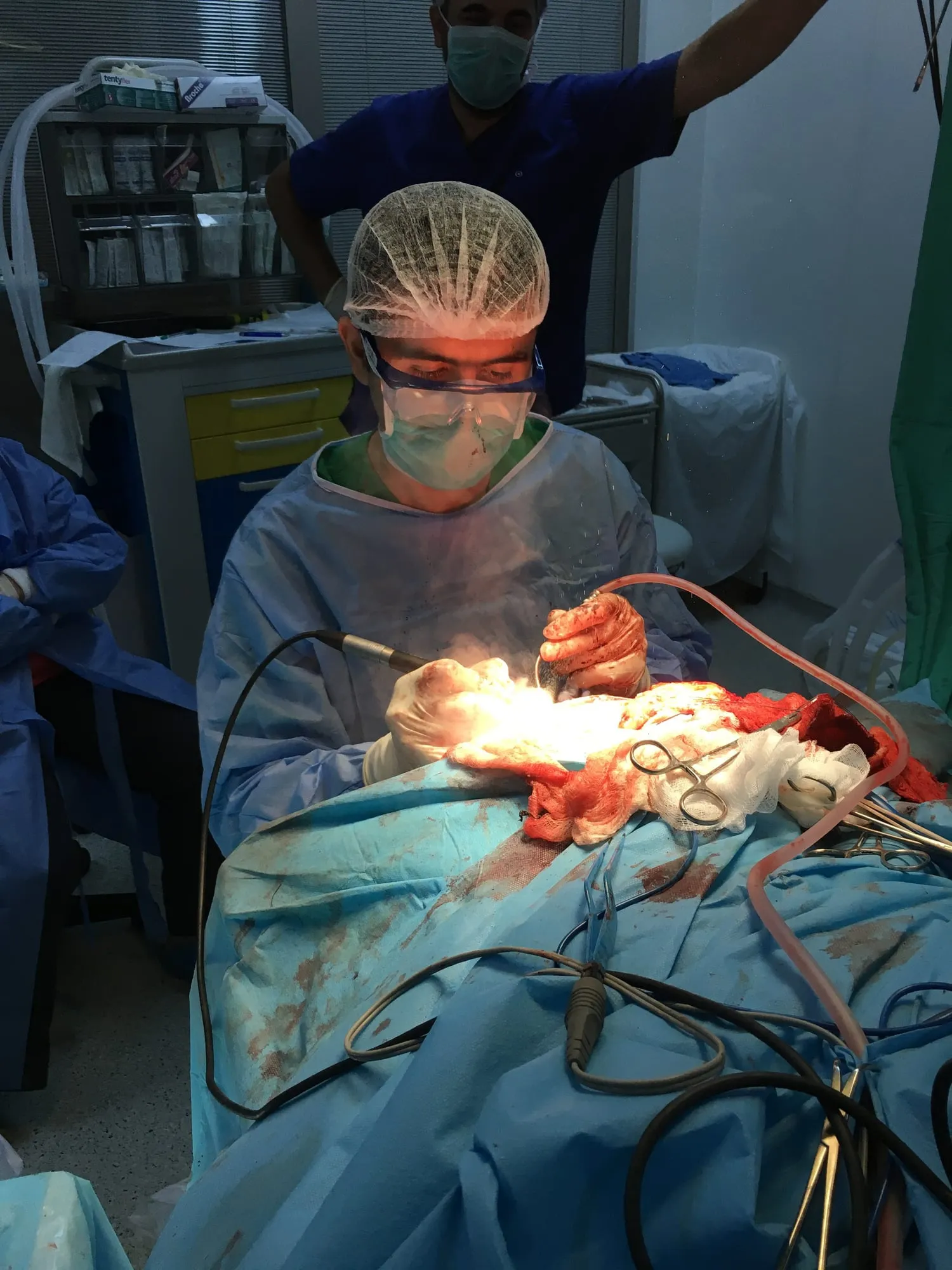 Cərrah böyüdücü eynək və baş işığı ilə əməliyyat edir